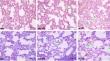 Response to chronic sustained hypoxia: increased cytosolic gelsolin and decreased plasma gelsolin levels