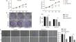 LINC00161 upregulated by M2-like tumor-associated macrophages promotes hepatocellular carcinoma progression by methylating HACE1 promoters