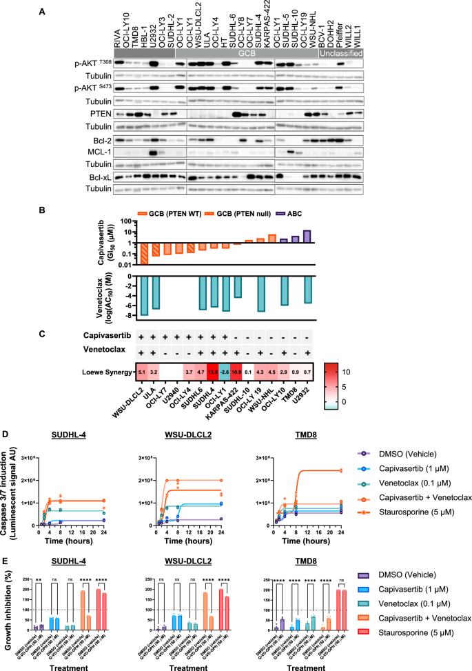 Potent combination benefit of the AKT inhibitor capivasertib and the BCL-2 inhibitor venetoclax in diffuse large B cell lymphoma