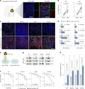 A cuproptosis nanocapsule for cancer radiotherapy