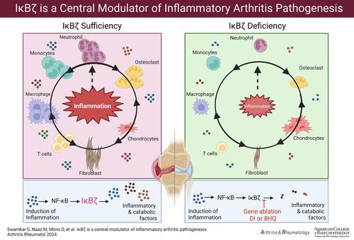 IĸBζ as a Central Modulator of Inflammatory Arthritis Pathogenesis