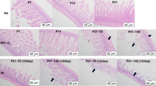 Gut microbiome and inflammation in response to increasing intermittent hypoxia in the neonatal rat