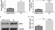 Roles and action mechanisms of NRIP1 in pre-eclampsia