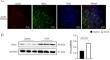 IKKα-STAT3-S727 axis: a novel mechanism in DOX-induced cardiomyopathy