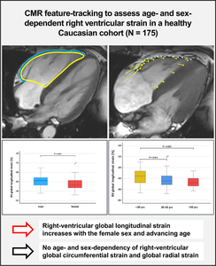 Assessment of CMR Feature-Tracking Age- and Sex-Dependent Right Ventricular Strain in a Healthy Caucasian Cohort