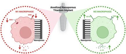 Inflammatory or Reparative? Tuning Macrophage Polarization Using Anodized Anisotropic Nanoporous Titanium Implant Surfaces