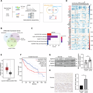 NUP37 accumulation mediated by TRIM28 enhances lipid synthesis to accelerate HCC progression