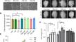 Simultaneous improvement of fiber yield and quality in upland cotton (Gossypium hirsutum L.) by integration of auxin transport and synthesis