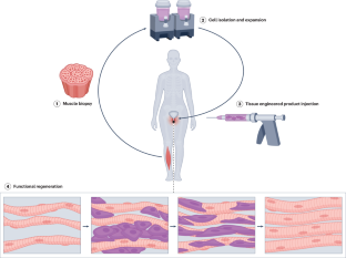 Treating stress urinary incontinence by tissue engineering