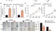 LncRNA HAND2-AS1 Inhibited Colon Cancer Progression By Regulating miR-3118/ZG16 Axis