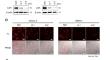 Lipolysis-stimulated lipoprotein receptor promote lipid uptake and fatty acid oxidation in gastric cancer