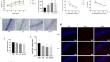 Occlusal disharmony promotes anxiety-like behaviours by suppressing Sirt1