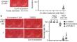 A Pyrazole Partially Induces Brassinosteroid-Related Gene Expression, Leading to Salt Stress Sensitivity