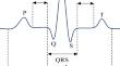 Double-layer data-hiding mechanism for ECG signals