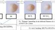 High-Purity Silica Produced from Sand Using a Novel Method Combining Acid Leaching and Thermal Processing