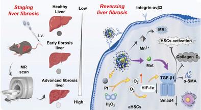 Enhanced Ferritin-Manganese Interaction by Nanoplatinum Growth Enabling Liver Fibrosis 3D Magnetic Resonance Visualization and Synergistic Therapy with Real-Time Monitoring