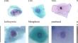 Classification of cervical cells from the Pap smear image using the RES_DCGAN data augmentation and ResNet50V2 with self-attention architecture