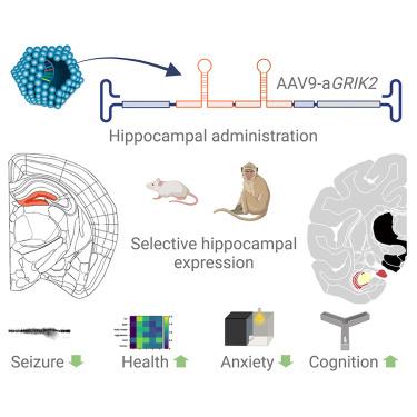 A novel AAV9-dual microRNA- vector targeting GRIK2 in the hippocampus as a treatment for mesial temporal lobe epilepsy