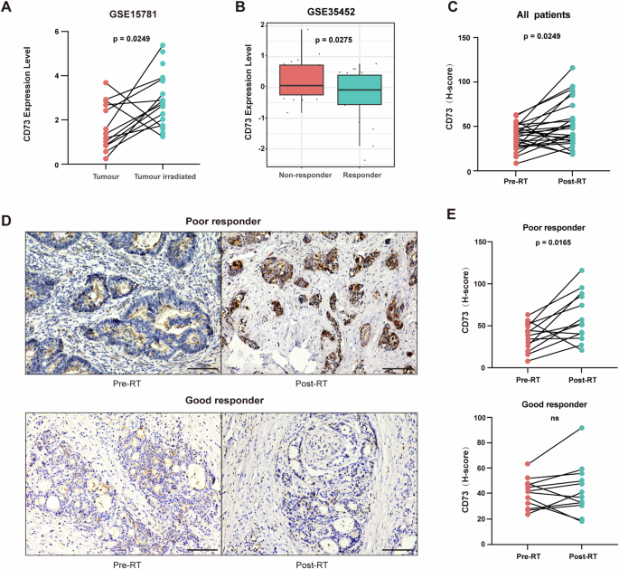 Blockade of CD73 potentiates radiotherapy antitumor immunity and abscopal effects via STING pathway