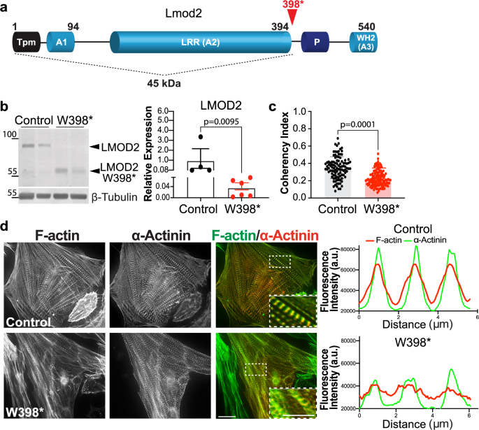 Leiomodin 2 neonatal dilated cardiomyopathy mutation results in altered actin gene signatures and cardiomyocyte dysfunction