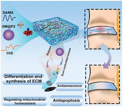 Hydrogel and Microgel Collaboration for Spatiotemporal Delivery of Biofactors to Awaken Nucleus Pulposus-Derived Stem Cells for Endogenous Repair of Disc.