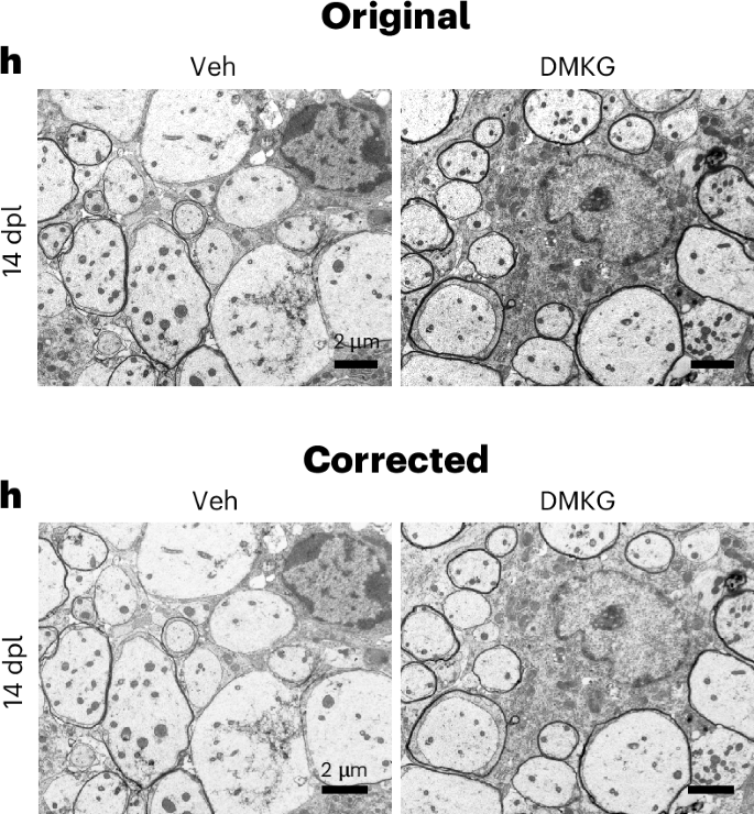 Publisher Correction: DOR activation in mature oligodendrocytes regulates α-ketoglutarate metabolism leading to enhanced remyelination in aged mice