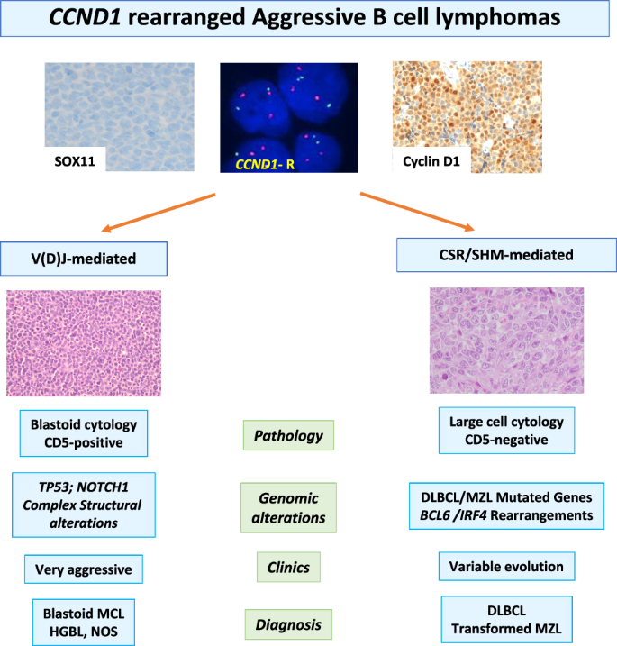 Large B-cell lymphomas with CCND1 rearrangement have different immunoglobulin gene breakpoints and genomic profile than mantle cell lymphoma.