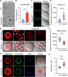 ARHGAP26 deficiency drives the oocyte aneuploidy and early embryonic development failure