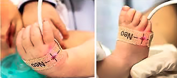 [Neonatal screening for critical congenital heart diseases in Peru: an urgent call].