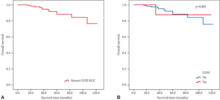 Long-Term Outcomes and Risk Factors for Lymph Node Metastasis in Siewert Type II/III Early Gastric Cancer.