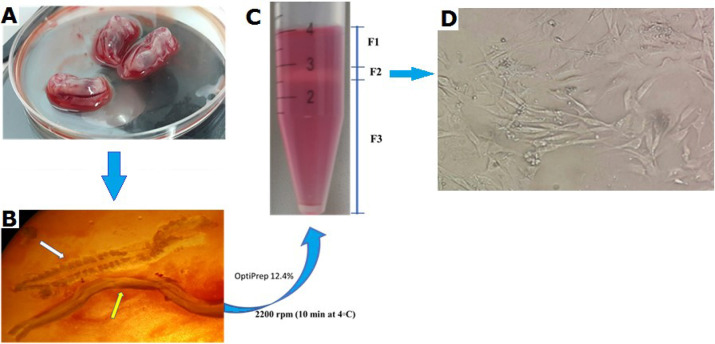 Adrenomedullin and Protecting Spinal Motor Neurons Against Doxorubicin-induced Toxicity.
