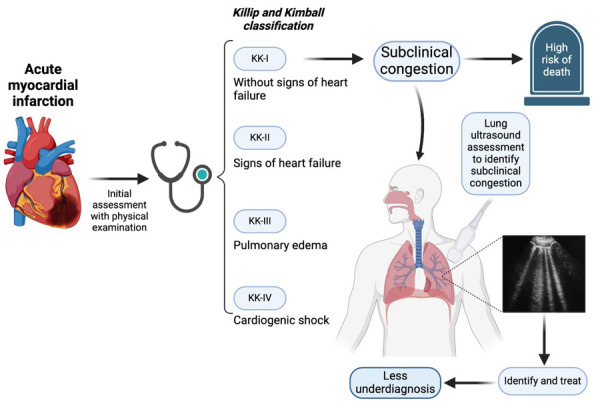 Killip and Kimball classification in the Ultrasound era: Is it time to redefine?