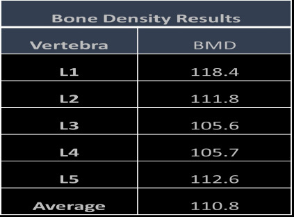 The Impact of Contrast Media on Lumbar Spine Bone Mineral Density Measured by Quantitative Computed Tomography.