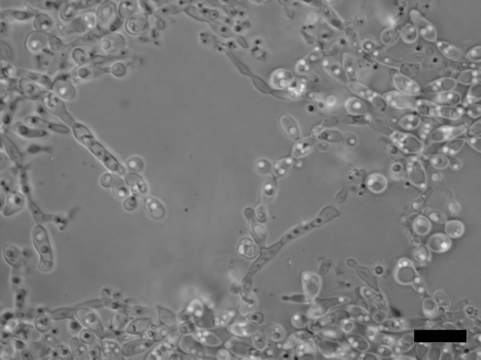 <i>Spencermartinsiella japonica</i> f.a., sp. nov., a novel yeast species isolated from biofilm in a reverse osmosis system.