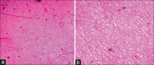 Microscopic evaluation of the effect of low-level laser therapy on platelet-rich fibrin: An <i>in vitro</i> study.