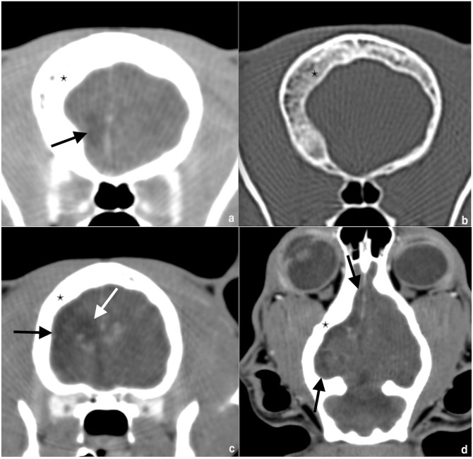 Dyke-Davidoff-Masson-like syndrome in an adult cat.