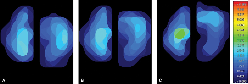 Evaluation of Meniscal Load and Load Distribution in the Sound Canine Stifle at Different Angles of Flexion.