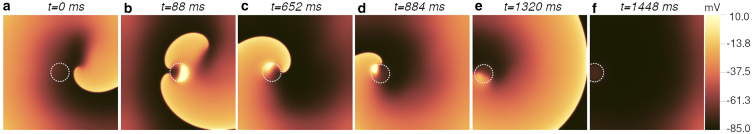 In silico thermal control of spiral wave dynamics in excitable cardiac tissue.