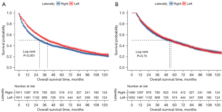 Effect of laterality on the postoperative survival of non-small cell lung cancer patients undergoing pneumonectomy.
