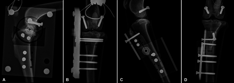 Evaluation of Meniscal Load and Load Distribution in the Sound Canine Stifle at Different Angles of Flexion.