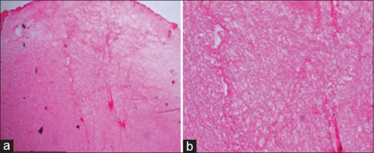 Microscopic evaluation of the effect of low-level laser therapy on platelet-rich fibrin: An <i>in vitro</i> study.