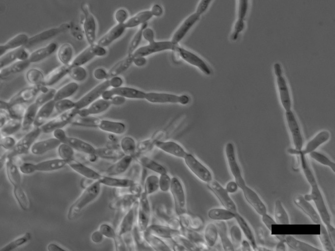 <i>Spencermartinsiella japonica</i> f.a., sp. nov., a novel yeast species isolated from biofilm in a reverse osmosis system.
