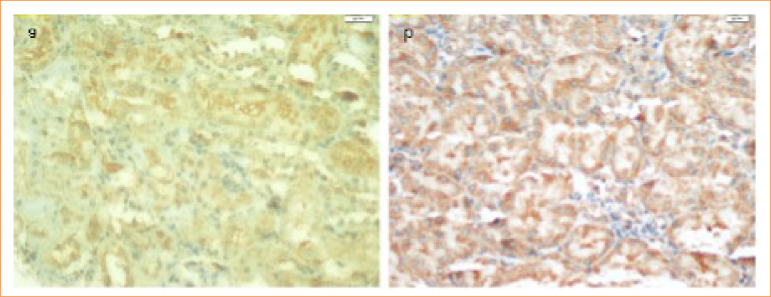 Can adalimumab prevent from acute effects of lipopolysaccharide induced renal injury in rats?