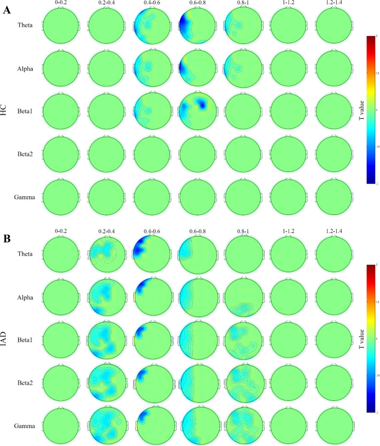Interference Control Under the Stroop Task and Brain Oscillatory Activity among Internet Addicts Compared to Non-addicts.