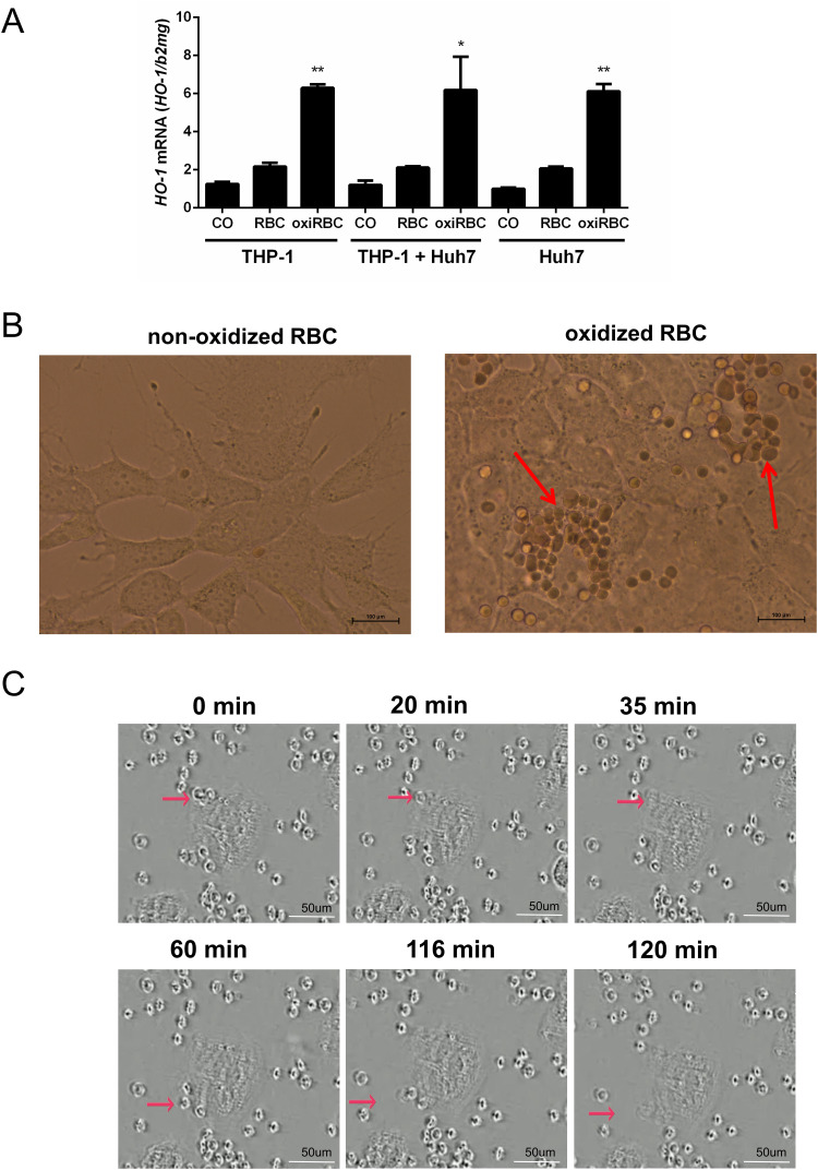 Direct Ingestion of Oxidized Red Blood Cells (Efferocytosis) by Hepatocytes.