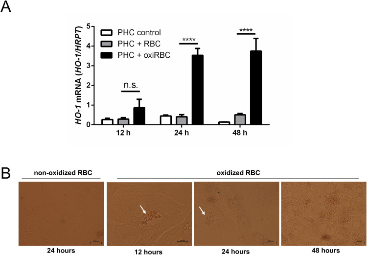 Direct Ingestion of Oxidized Red Blood Cells (Efferocytosis) by Hepatocytes.