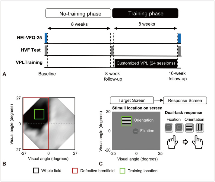 Customized Visual Discrimination Digital Therapy According to Visual Field Defects in Chronic Stroke Patients.