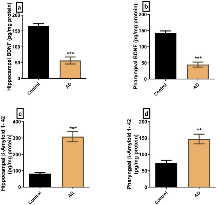 Structural Changes in Pharyngeal and Tongue Muscles as a Potential Contributor to Dysphagia in Alzheimer Disease Rat Model.