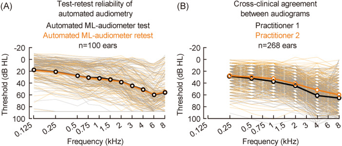 Performance and reliability evaluation of an improved machine learning-based pure-tone audiometry with automated masking.