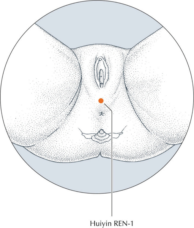 Could a simple manual technique performed by a midwife reduce the incidence of episiotomy and perineal lacerations? A non-randomized pilot study.